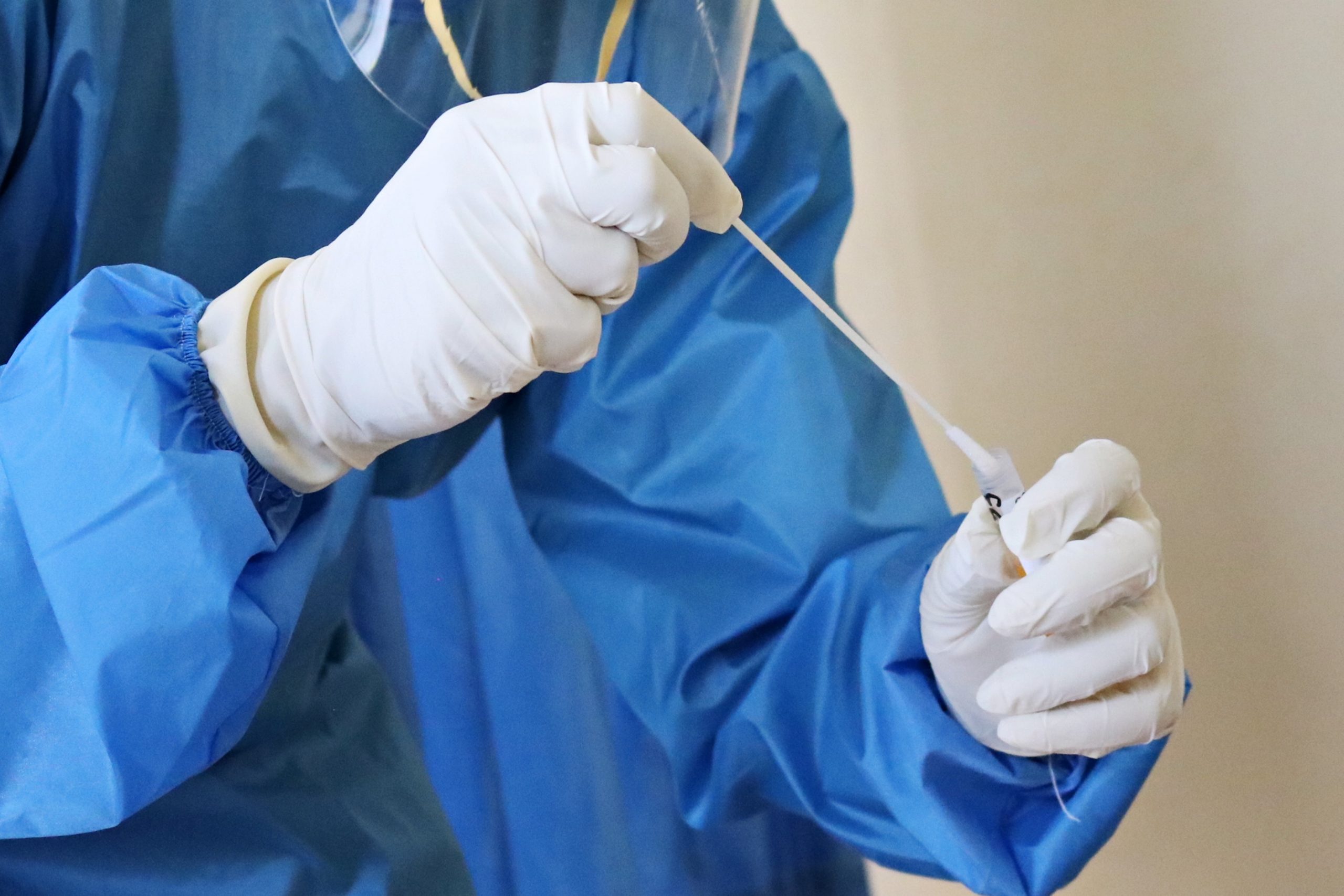 Tóquio aumentará a capacidade de testes COVID-19 para mais de 60 mil por dia