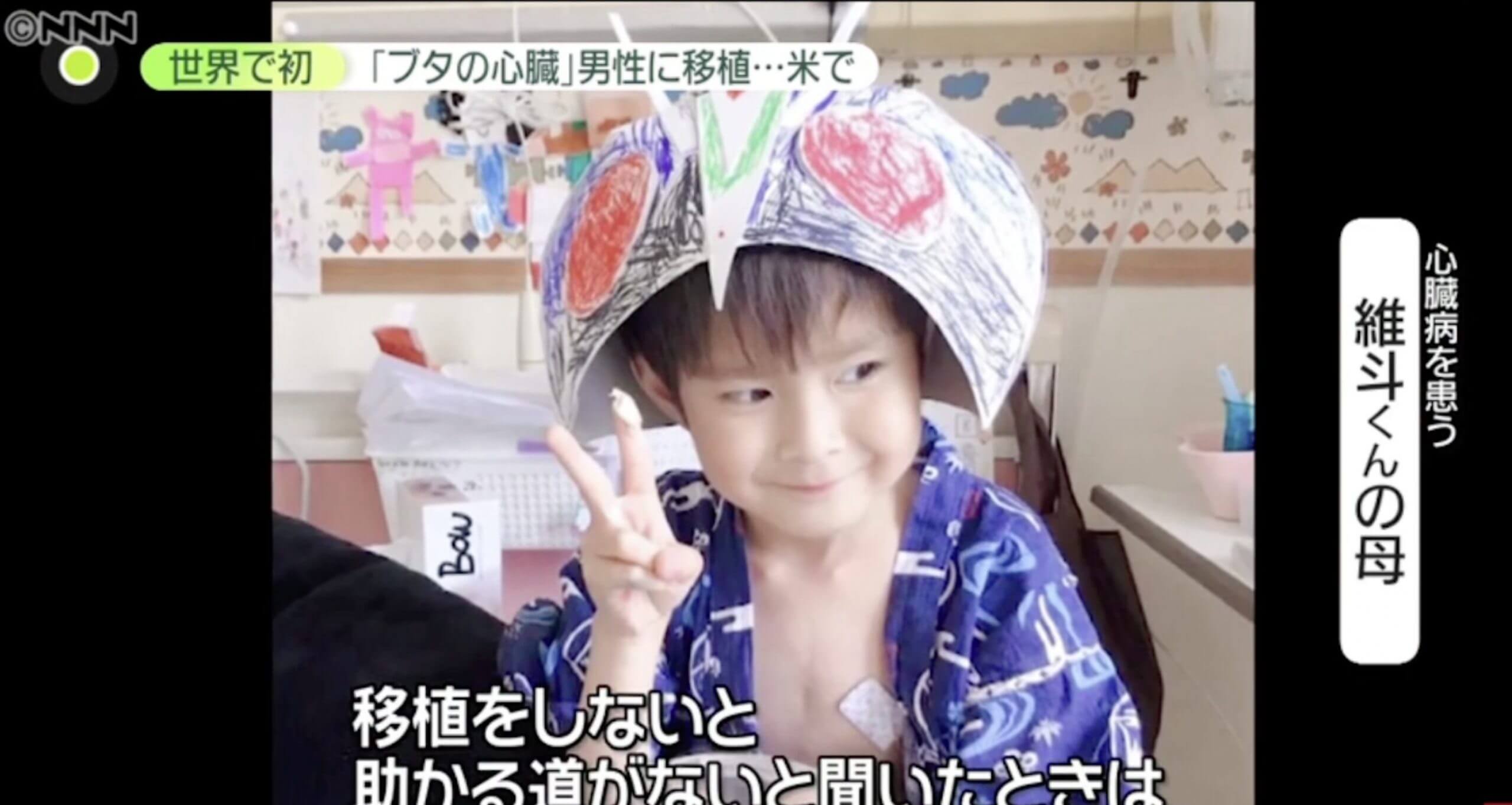 Transplante de coração de porco, trás esperança a criança japonesa com doença cardíaca